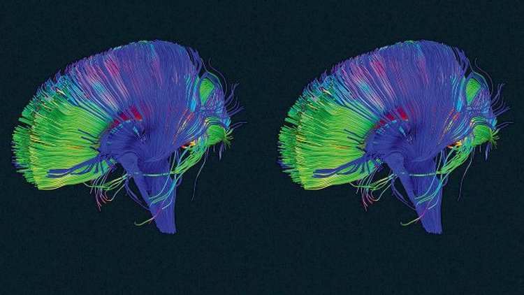 3059634 poster p 2 your most productive selfyour brain has a delete button heres how to use it 640x360