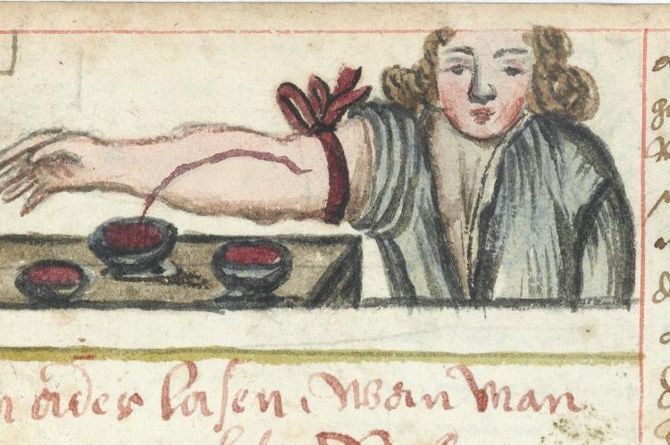 bloodletting hires1 e1446145660227